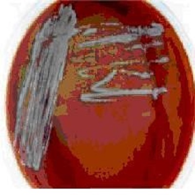 أنواع الأوساط الغذائيةMedia   وخصائصها 