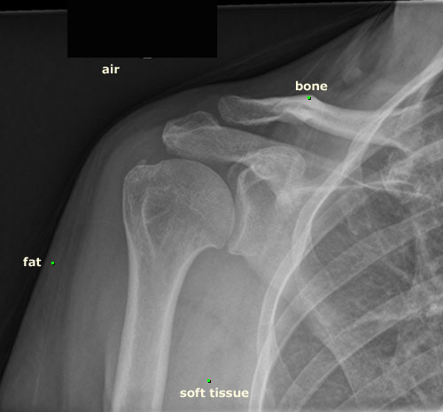 Factors Affecting Appearance
