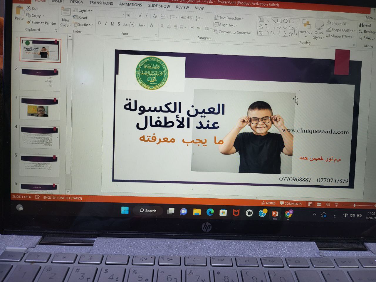 ندوة علمية بعنوان (العيون الكسولة عن الاطفال)