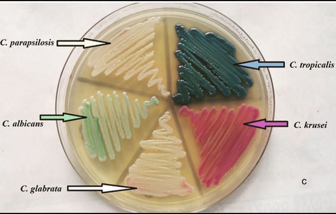 قسم تقنيات المختبرات الطبية في كلية المستقبل الجامعة يقيم ورشة علمية عن أنواع الاوساط الزرعية
