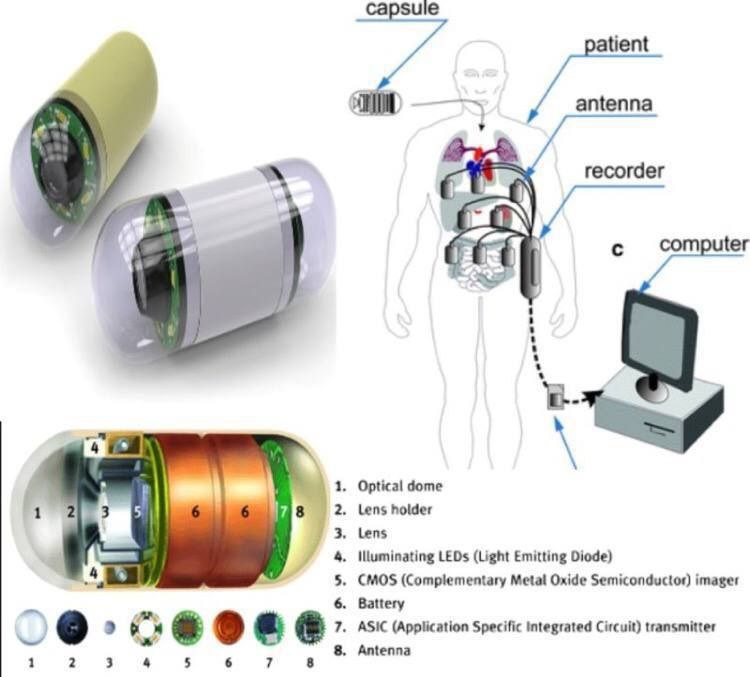 حلقة نقاشية بعنوان " كبسولة التنظير ( capsule endoscopy) "