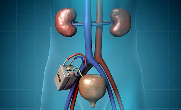 حلقة نقاشية بعنوان " زراعة الكلى الاصطناعية "