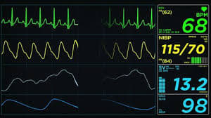 حلقة نقاشية "(HRM)heart rate monitor"