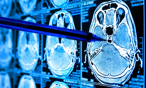 مقالة علمية للدكتور ميثم نبيل عجام بعنوان "اهمية استخدام الكوريثم الذكاء الصناعي CNN في تشخیص سرطان الثدي"