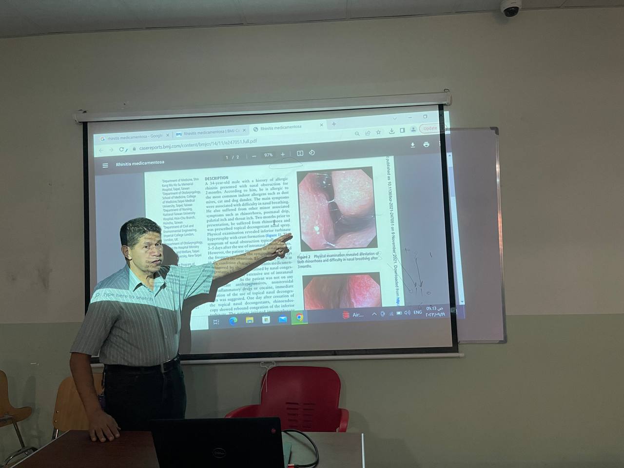 ورشه علمية للتدريسي د.علي حسين النصراوي بعنوان  (rhinitis medicamentosa)