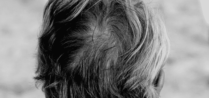 لماذا يتحول الشعر من اللون الاسود إلى اللون الرمادي؟