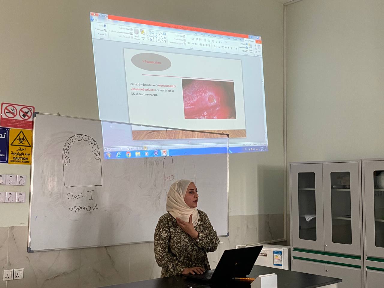 التليفات الفموية وعلاقتها باطقم الاسنان المتحركة