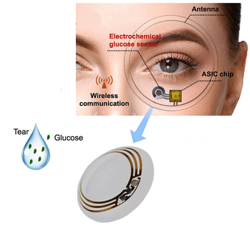 مقالة علمية للتدريسي حسن عبد الهادي الجابري بعنوان ((العدسات اللاصقة الذكية للكشف عن مستويات الكلوكوز لمرضى السكري))