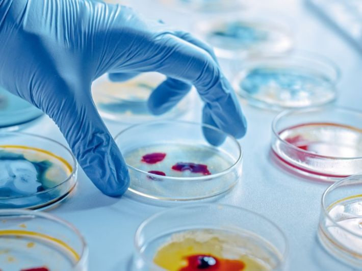 مقالة علمية للانسة نور الهدى عزمي حسن بعنوان "الميكروبات: جنود غير مرئيين في عالم الصناعات"