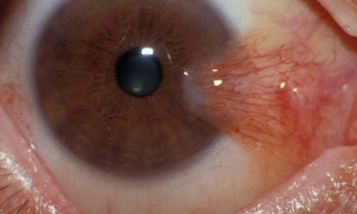 مقالة علمية للتدريسي علي هادي معيدي بعنوان (الظفرة).