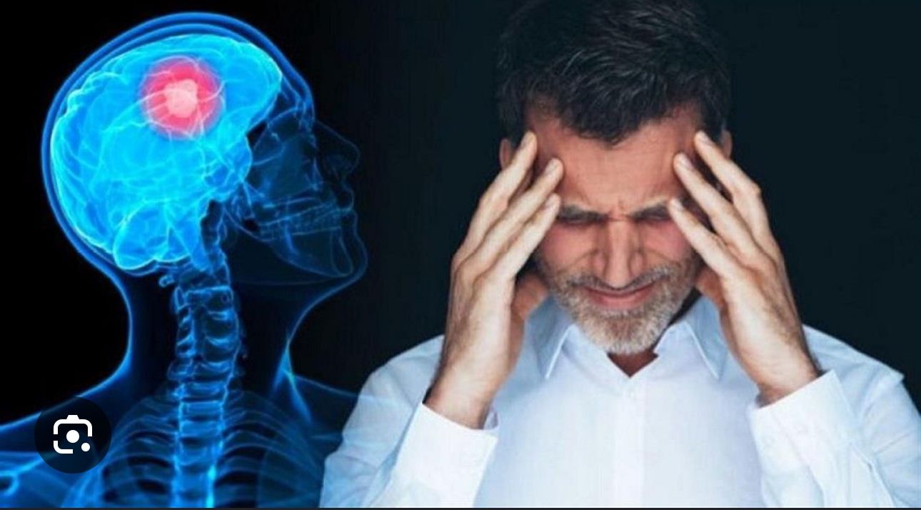 ارتجاج المخ