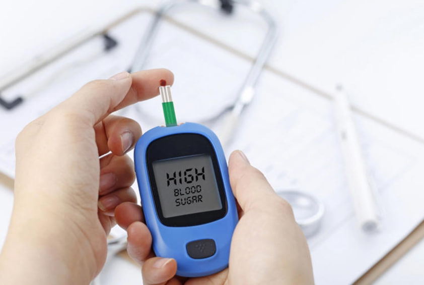 مقالة علمية ل(م.د سارة كامل عبود ) بعنوان ""تحليل السكر العشوائي""