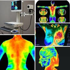 الابتكارات في استخدام الأشعة تحت الحمراء والتصوير الحراري في الكشف عن الأورام م. م. ضرغام يوسف جواد 