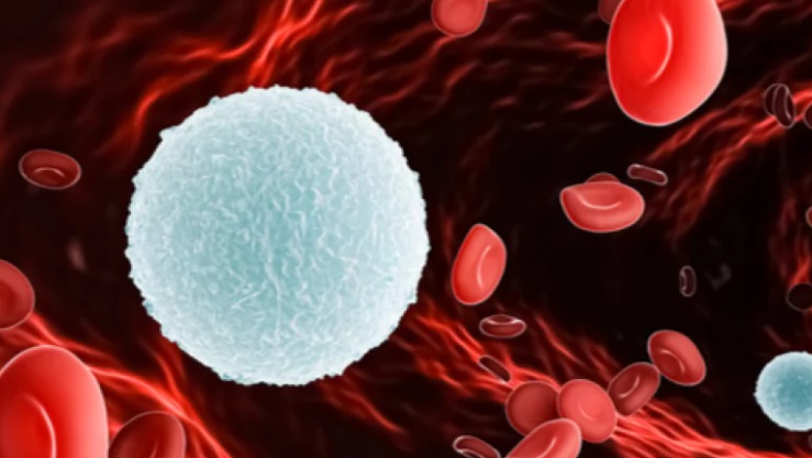 " أسباب تضخم كريات الدم البيضاء " د. اثمار محمد رضا