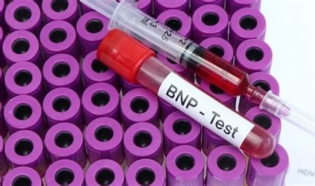 "  فحصBNP   " بقلم م.د. عياد عبدالسلام