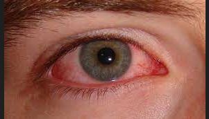 مقالة علمية للتدريسي م.م مهيمن سمير عارف بعنوان (أثر الحرارة على الين: دراسة شاملة)