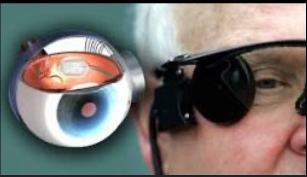 حلقة نقاشية "العين الاصطناعية؟"