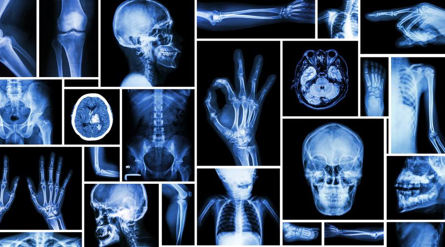 حلقة نقاشية "الأشعة السينية"