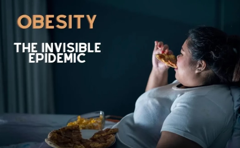 " Obesity  "  by dr sally moaid allosh