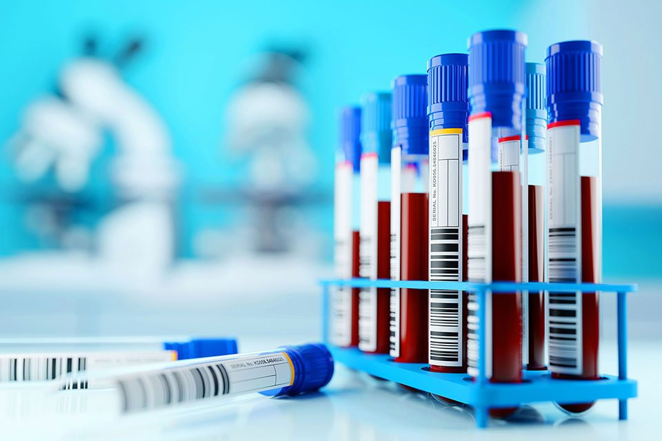 مقالة علمية للانسة نور الهدى عزمي بعنوان "استخدام البرمجيات الخاصة بتحليل الدم "