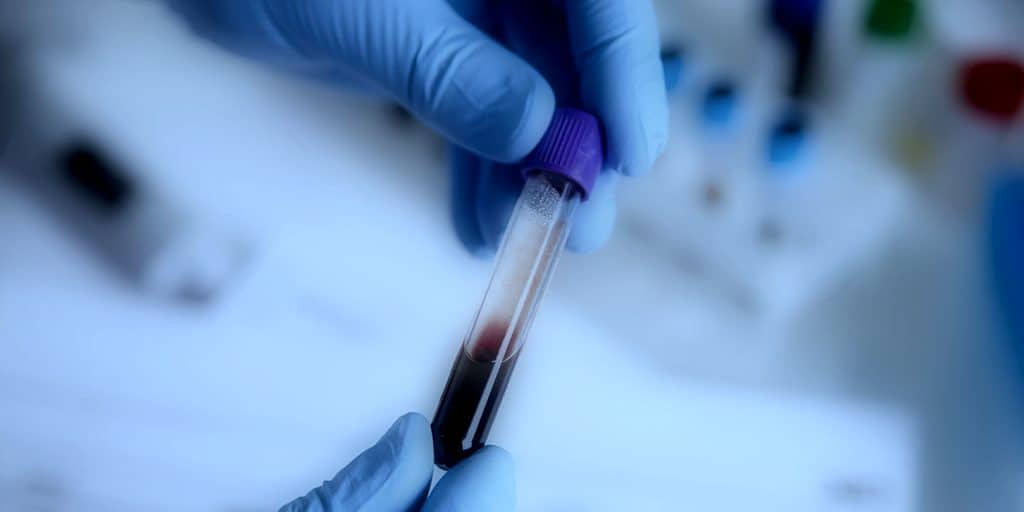 مقالة علمية للانسة نور الهدى عزمي بعنوان "دور تحاليل الدم في مراقبة الصحة العامة "