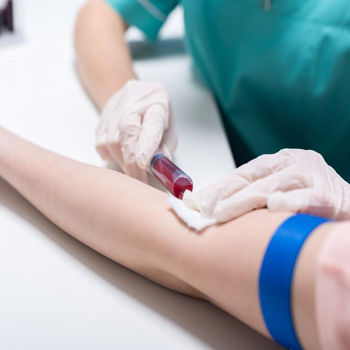 Colorectal Cancer Screening: Where Does the Shield Liquid Biopsy Fit In?