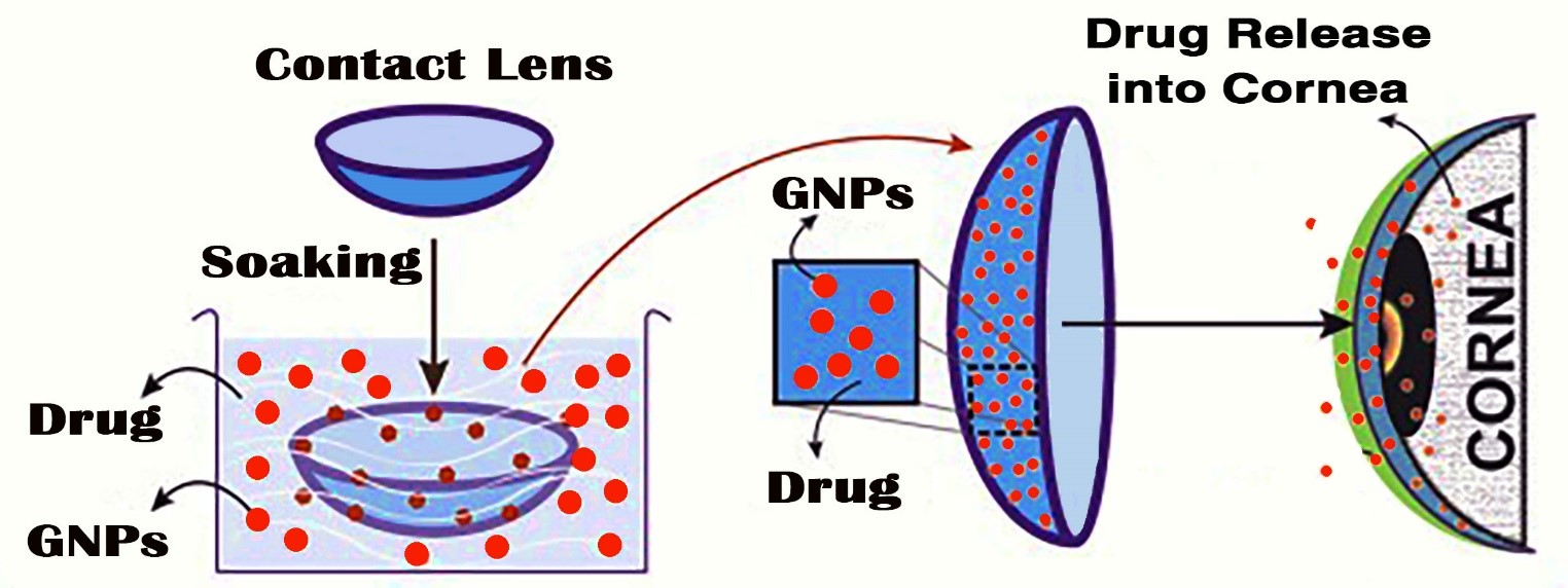 مقالة علمية للمعيد حسن عبد الهادي الجابري بعنوان ((عدسات لاصقة مشبعة بحبيبات الذهب النانوية لعلاج مرض الكلوكوما))
