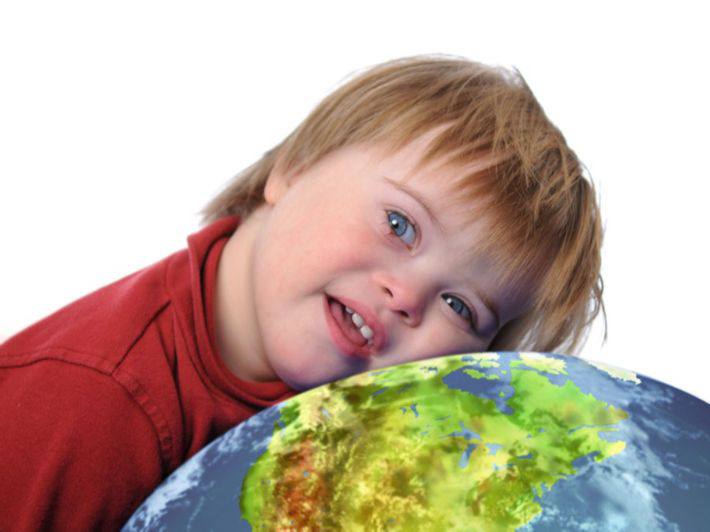 مقالة علمية بعنوان "متلازمة داون " للطالب (حسنين فلاح حسن ) من كلية العلوم - قسم علوم الفيزياء الطبية - المرحلة الثانية -وباشراف الاستاذ (م.م علي جعفر عبيد)