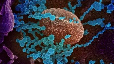 مقالة علمية بعنوان " اعراض نقص افراز الغدة الدرقية" للتدريسية (م.م نداء فاضل عزيز)