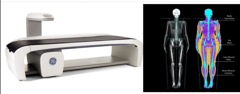 حلقة نقاشية " الماسحات الضوئية DEXA scane results "