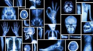 مقالة علمية بعنوان "الاشعة السينية" للطالب (امير عصام كردي) كلية العلوم–قسم علوم الفيزياء الطبية–المرحلة الثانية كروب H وبإشراف الاستاذ(م.م علي حيدر)