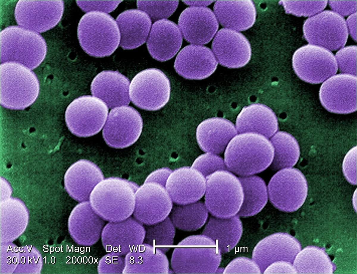 مقالة علمية للتدريسية (ا.م.د اصيل هاشم راضي ) بعنوان "البكتريا المرضية  Staphylococcus "