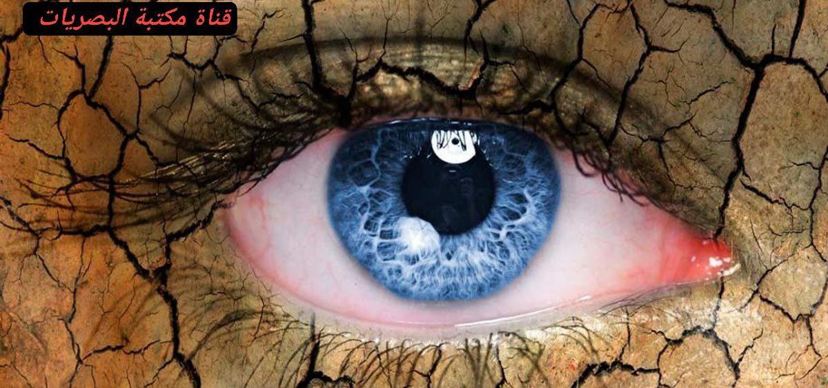 مقالة علمية للتدريسي م.م مهيمن سمير عارف بعنوان (جفاف العين)