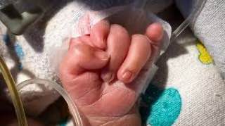 مقالة علمية بعنوان "التشوهات الخلقيه " للطالبة (زهراء جبر جايان) جامعة المستقبل-كلية العلوم-قسم علوم الفيزياء الطبية- المرحلة الثالثة  كروب Gوبأشراف (م.م علي جعفر عبيد)