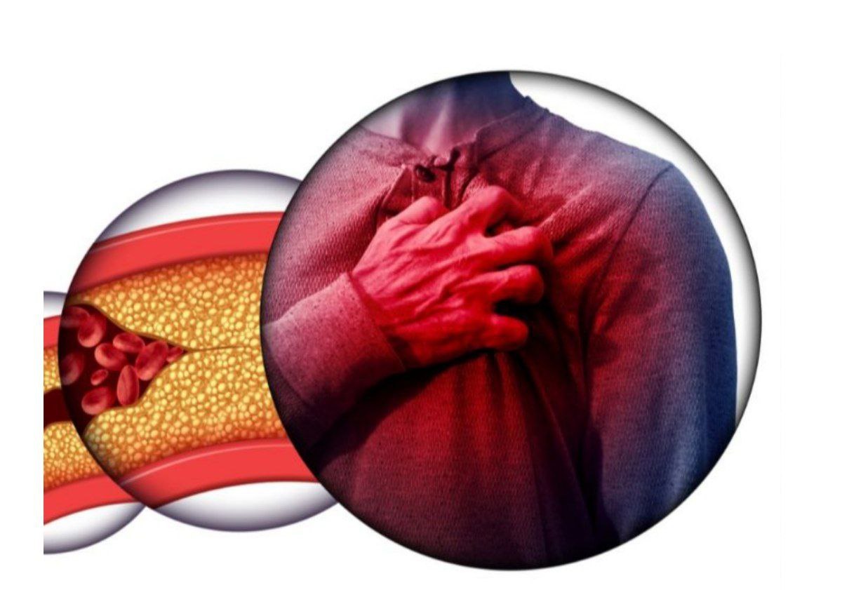 مقالة علمية  بعنوان "تصلب الشرايين" للطالبة (راوند مسلم حسن )–كلية العلوم– قسم علوم الفيزياء الطبية–المرحلة الثالثة– كروب i وباشراف (م.م علي جعفر عبيد)