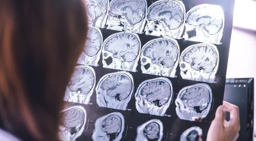 مقاله علميه بعنوان " الضمور الدماغي    " للطالبه (راوند مسلم حسن ) جامعة المستقبل-كلية العلوم-قسم علوم الفيزياء الطبية- المرحله الثالثه -كروب i وبأشراف (م.م علي جعفر عبيد) 