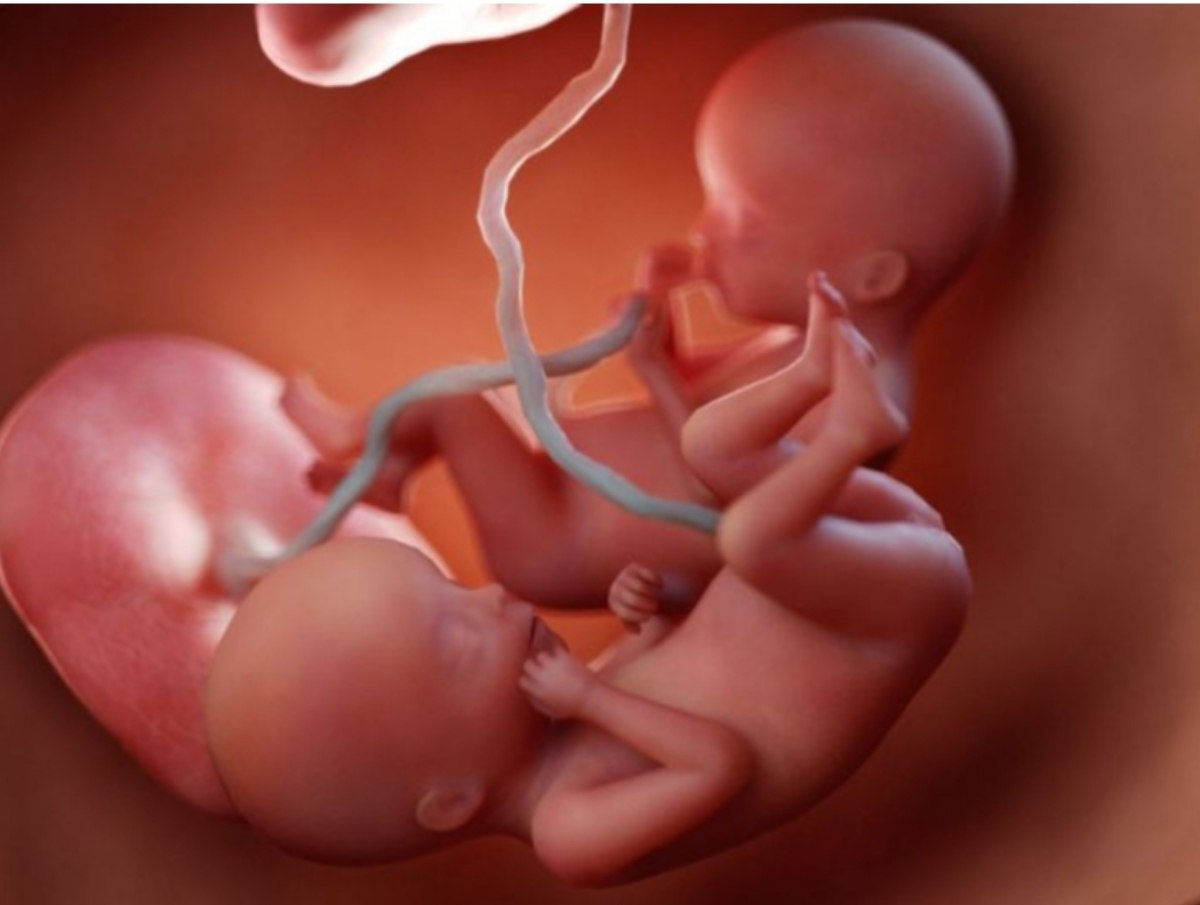 مقالة علمية بعنوان "التوائم المتماثلة وغير المتماثلة" للطالبة (ريتاج قصي كريم) جامعة المستقبل-كلية العلوم-قسم علوم الفيزياء الطبية- المرحلة الثانيه_كروبE وبأشراف (م.م علي جعفر عبيد)