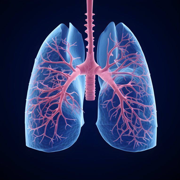 A Scientific Article  By Abdulhassan Sauad Jabbar Entitled: Chronic Lower Respiratory Tract Bacterial Infections and Their Possible Association with Lung Cancer