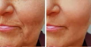 مقاله علمية للانسة ( هبه صلاح هادي ) بعنوان ""الكولاجين""