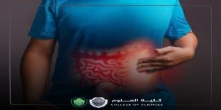 مقالة علمية للانسة ( هبه صلاح هادي ) بعنوان ""القالون العصبي ""