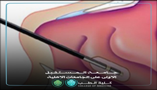 مقالة بعنوان استخدام جراحة الكوبليشن في علاج التهاب الأنف التحسسي