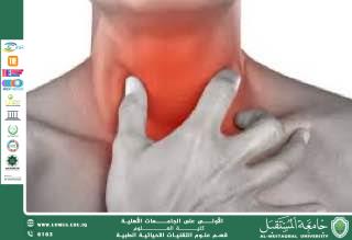 مقالة علمية ل( هبه صلاح هادي ) بعنوان "" الغدد اللمفاوية ""