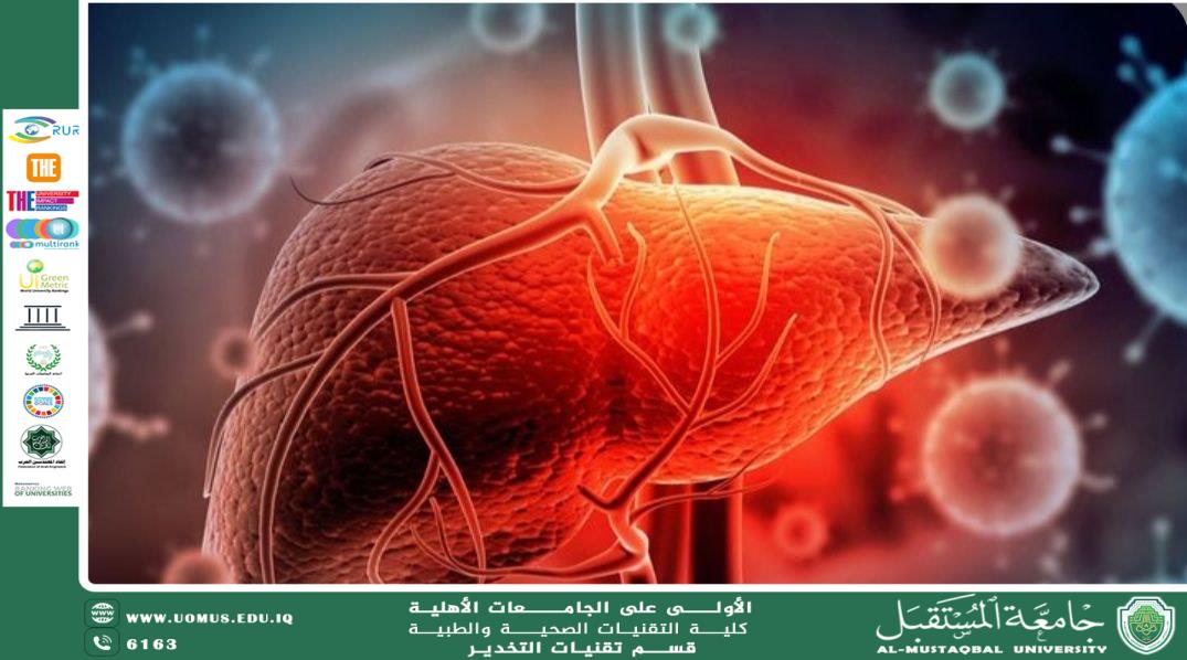 التهاب الكبد 