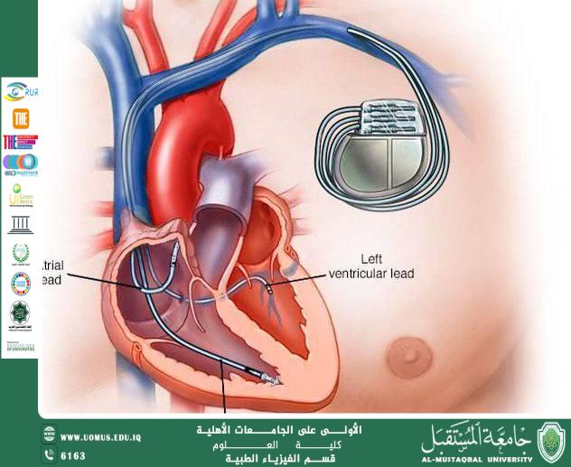 مقالة علمية للمعيده ( مريم لطيف شندل ) بعنوان "جهاز تنظيم ضربات القلب".