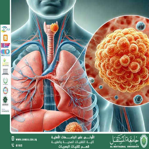 مقالة علمية للمعيدة تمارا نهاد عباس بعنوان(الاورام). 