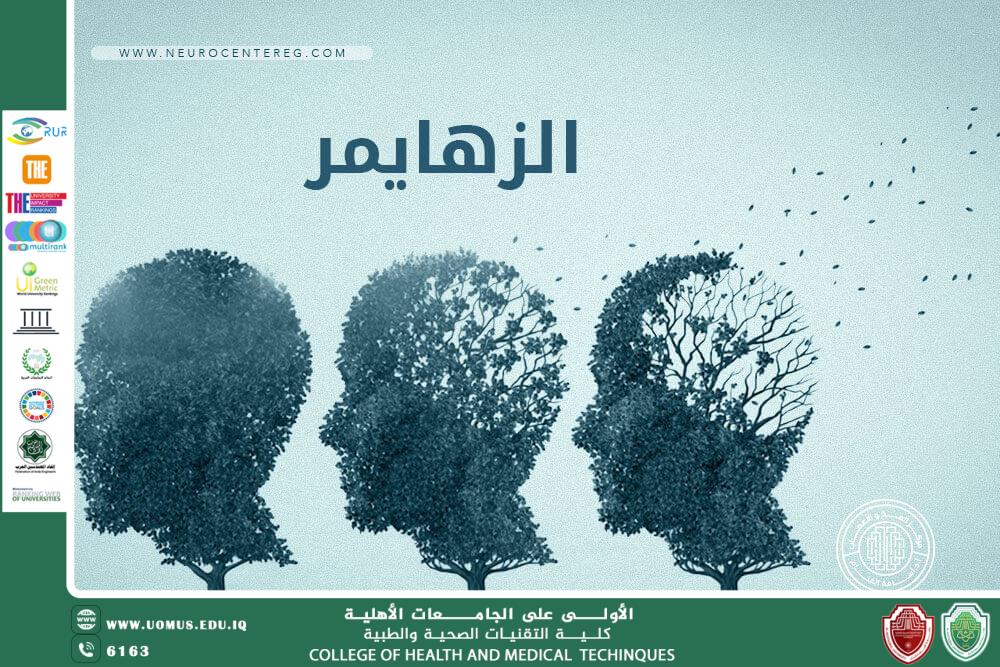 ما هو مرض الزهايمر؟ 