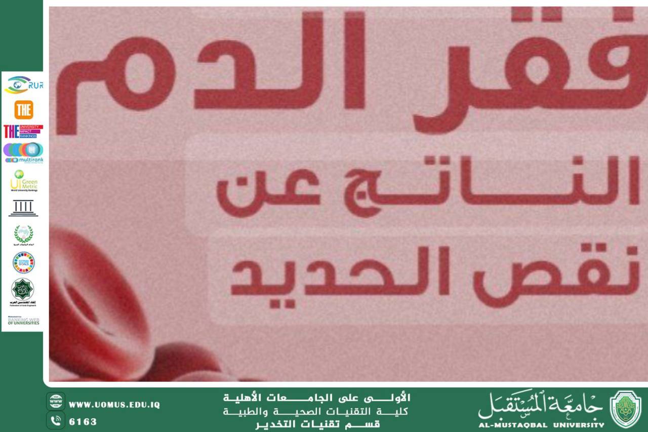 فقر الدم بسبب نقص الحديد