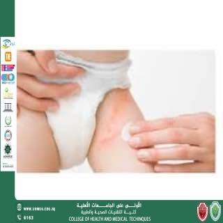 الطفح الجلدي الناتج عن الحفاض (Diaper Rash)