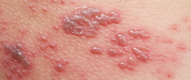 مقالة علمية للتدريسية (م.م زينب ناظم عزيز) بعنوان " الحزام الناري "