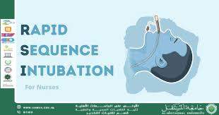 Rapid Sequence Anesthesia: A Critical Procedure for Airway Management